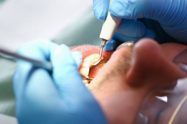 Best Emergency Dental Surgery in Montgomery, TX